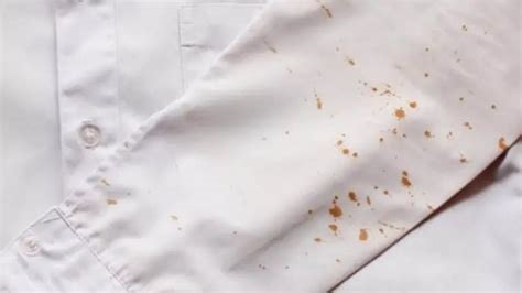 البقع المستعصية 